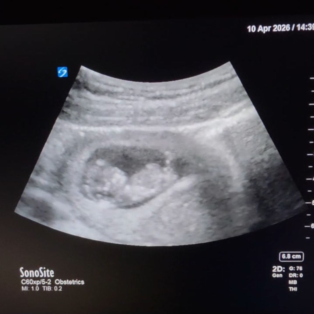 Photo shared by Halle for their Babylist baby registry.