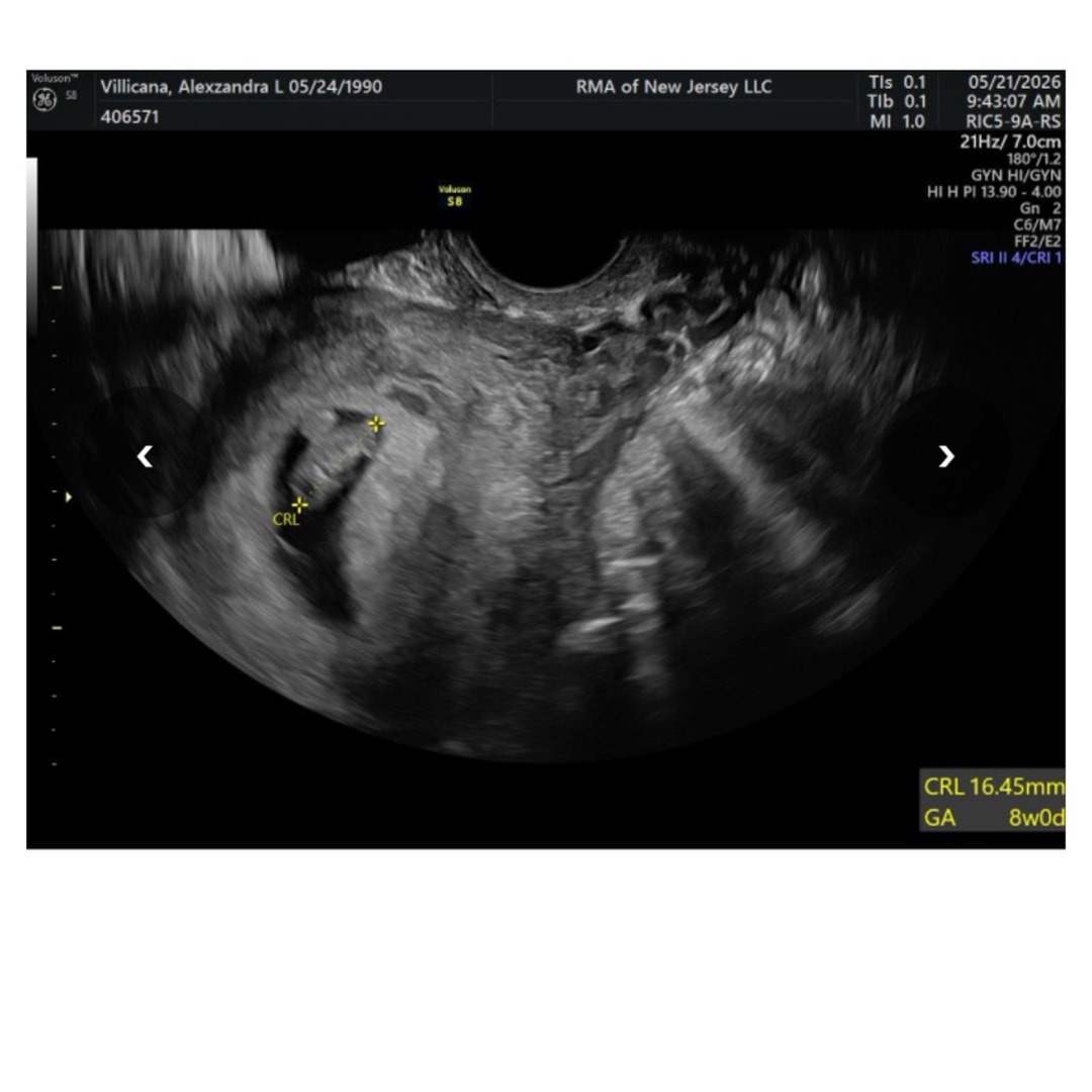 Photo shared by Alexzandra for their Babylist baby registry.