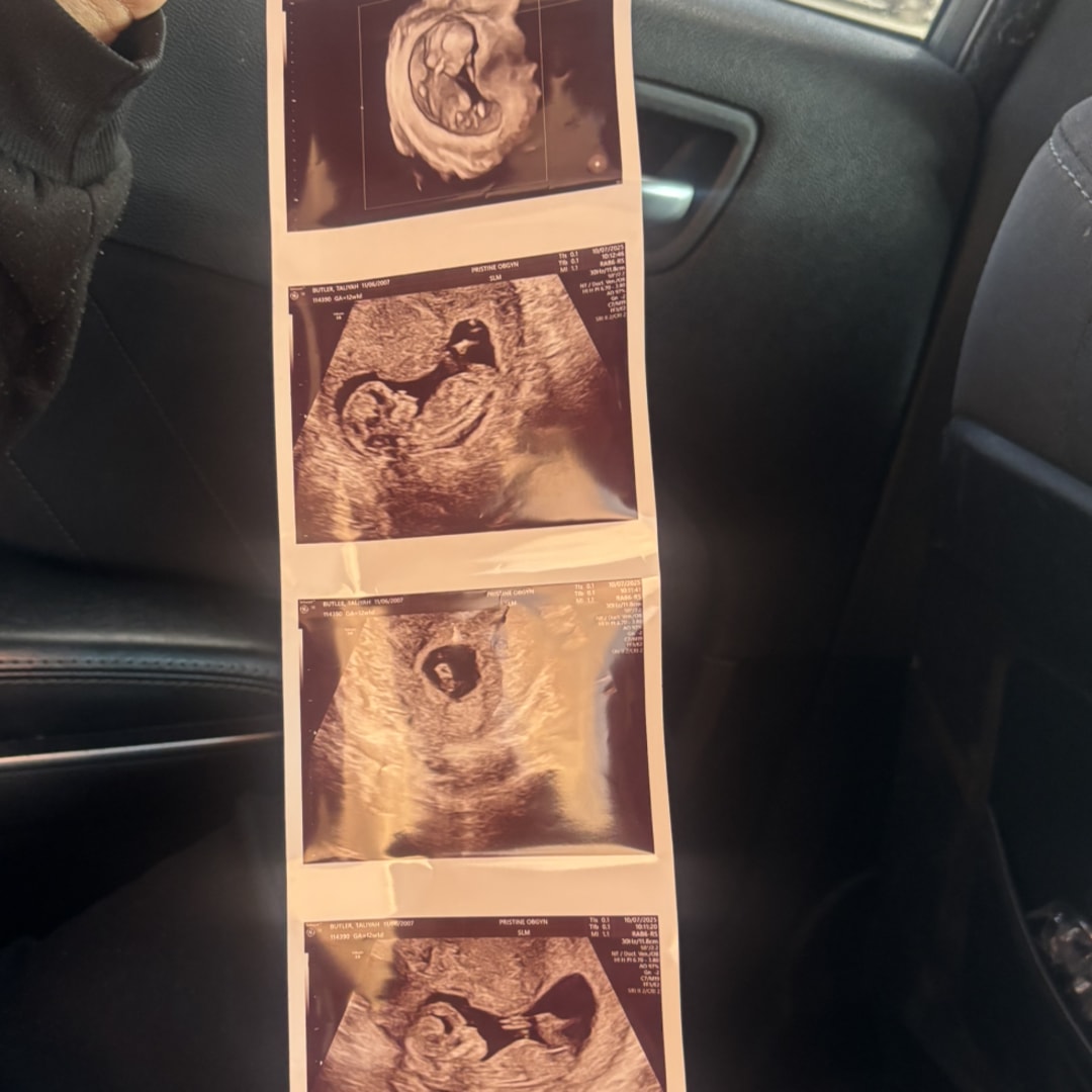 Photo shared by Taliyah for their Babylist baby registry.