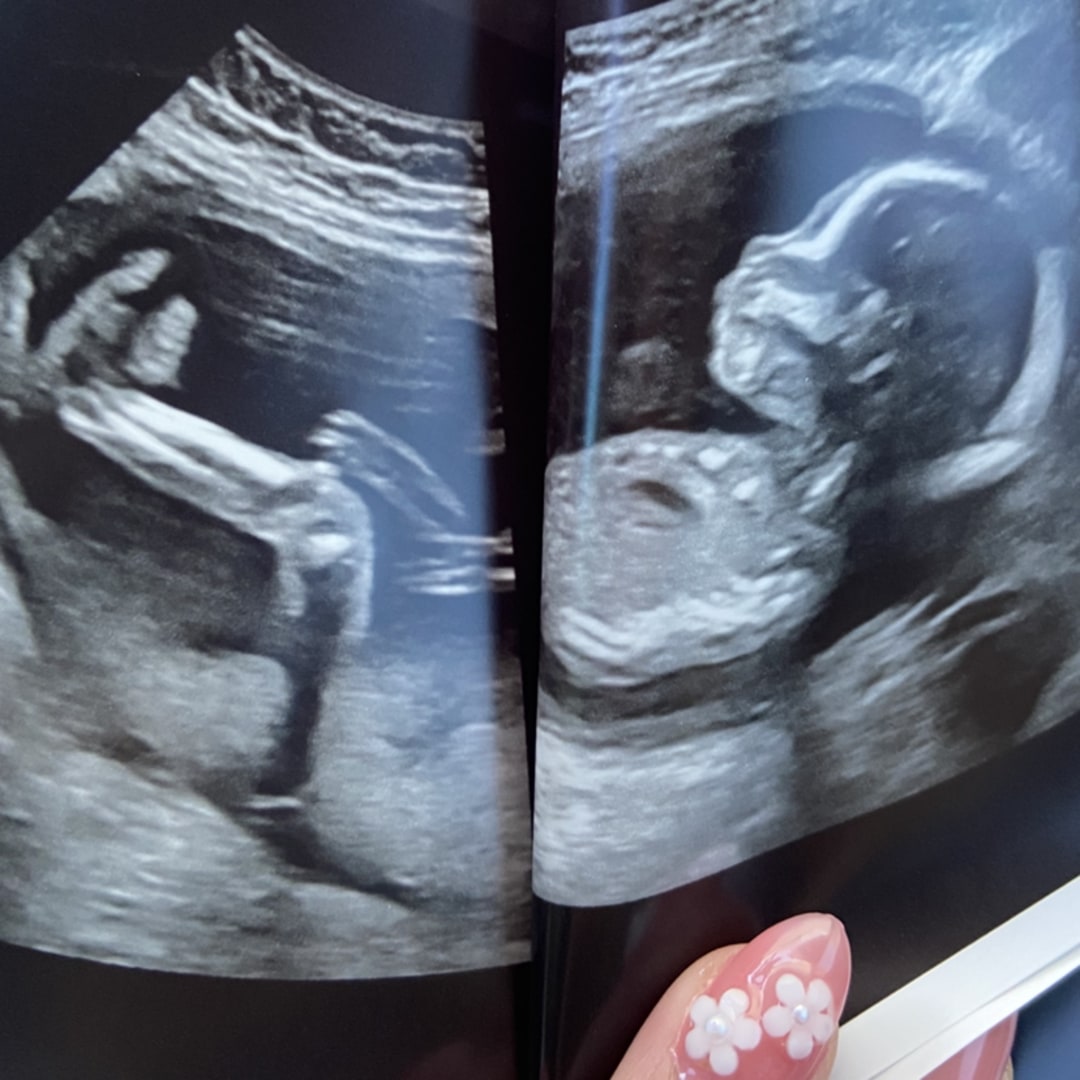 Photo shared by Camille Joy for their Babylist baby registry.