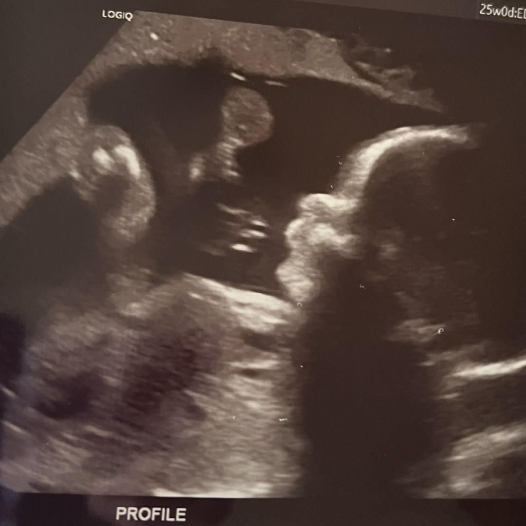 Photo shared by Jenessa for their Babylist baby registry.