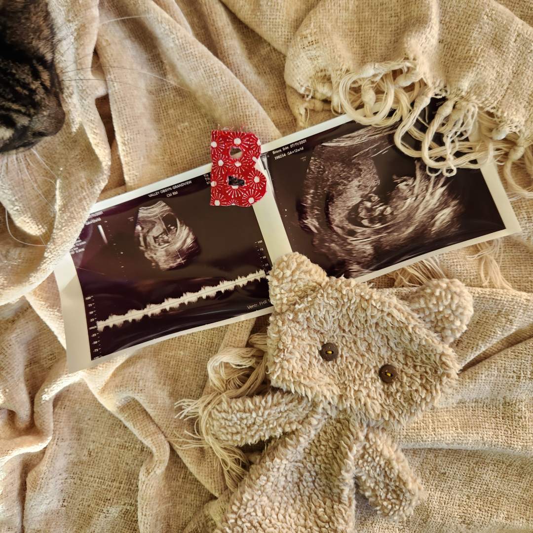 Photo shared by Erin for their Babylist baby registry.