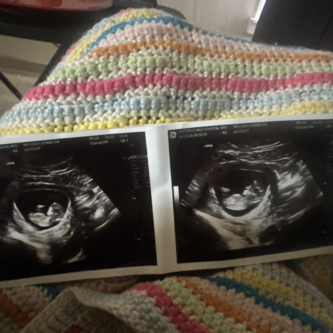 Photo shared by Terracita for their Babylist baby registry.
