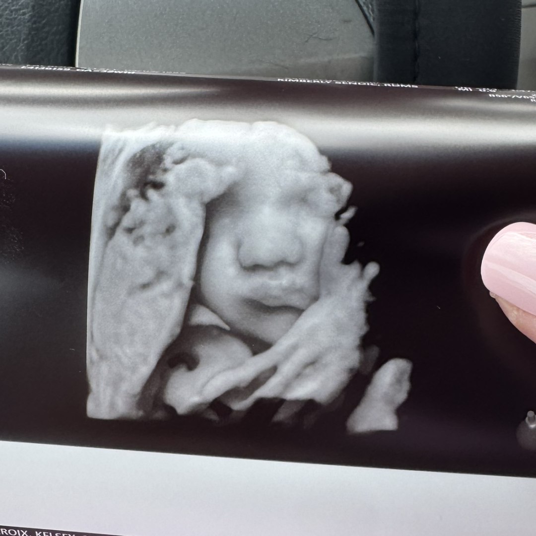 Photo shared by Kelsey for their Babylist baby registry.