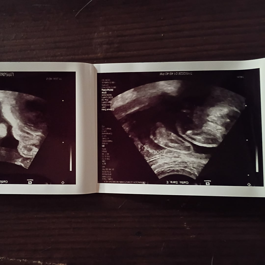 Photo shared by Sara for their Babylist baby registry.