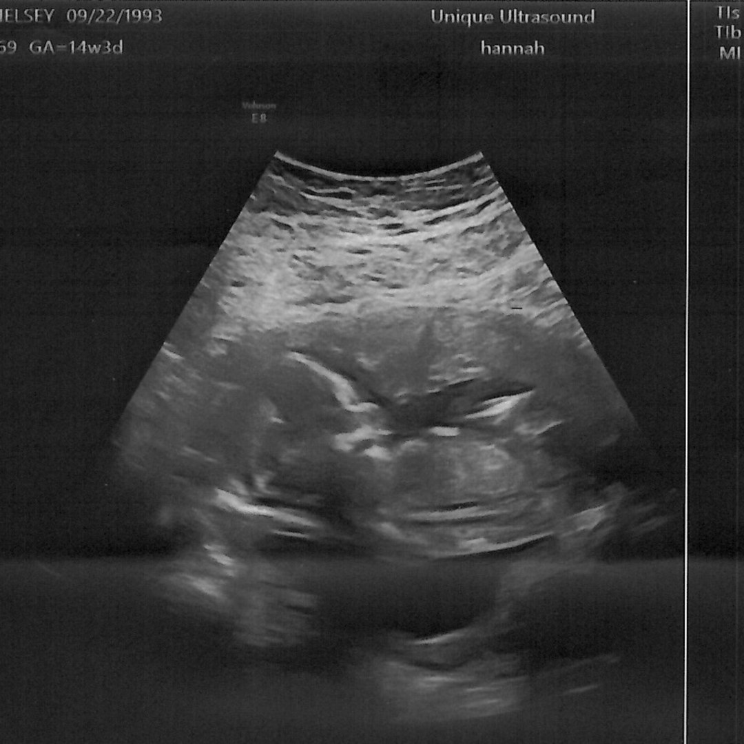 Photo shared by Chelsey for their Babylist baby registry.