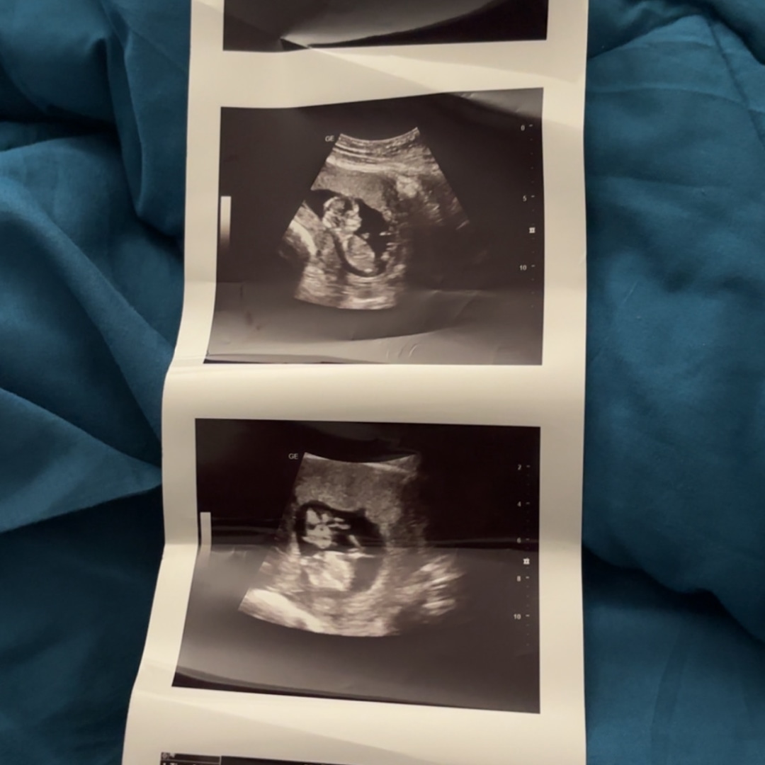 Photo shared by D'Andria for their Babylist baby registry.