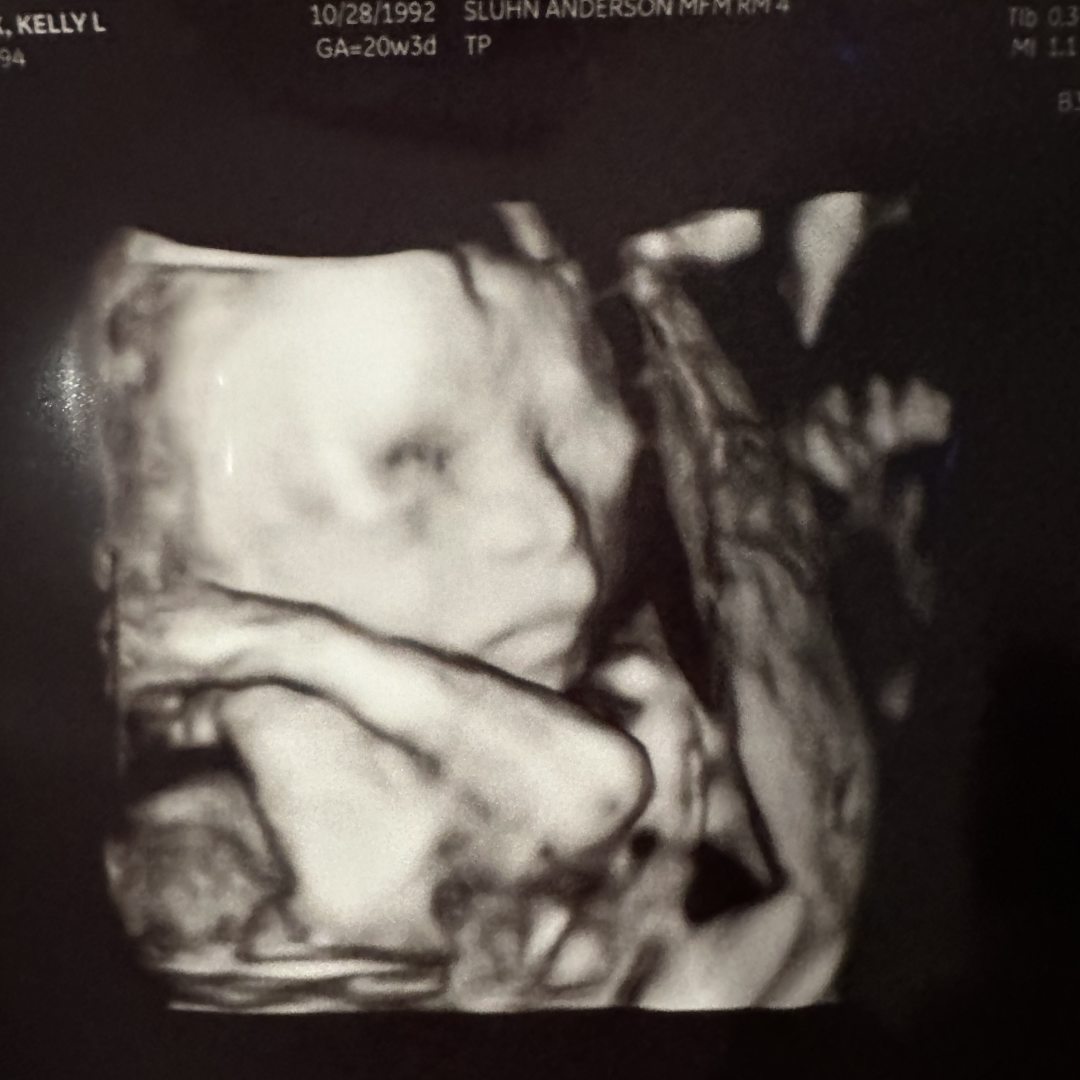 Photo shared by Kelly for their Babylist baby registry.