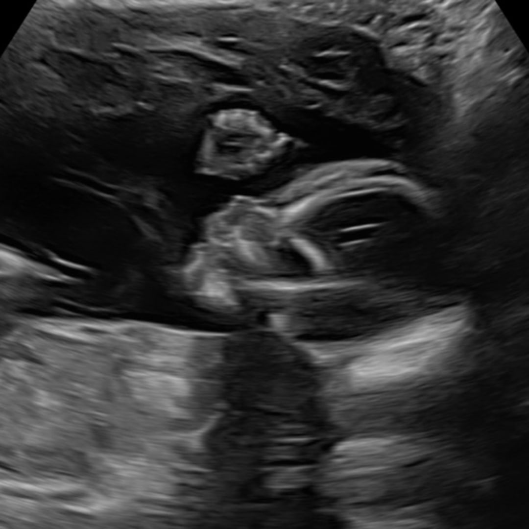 Photo shared by Elizabeth for their Babylist baby registry.