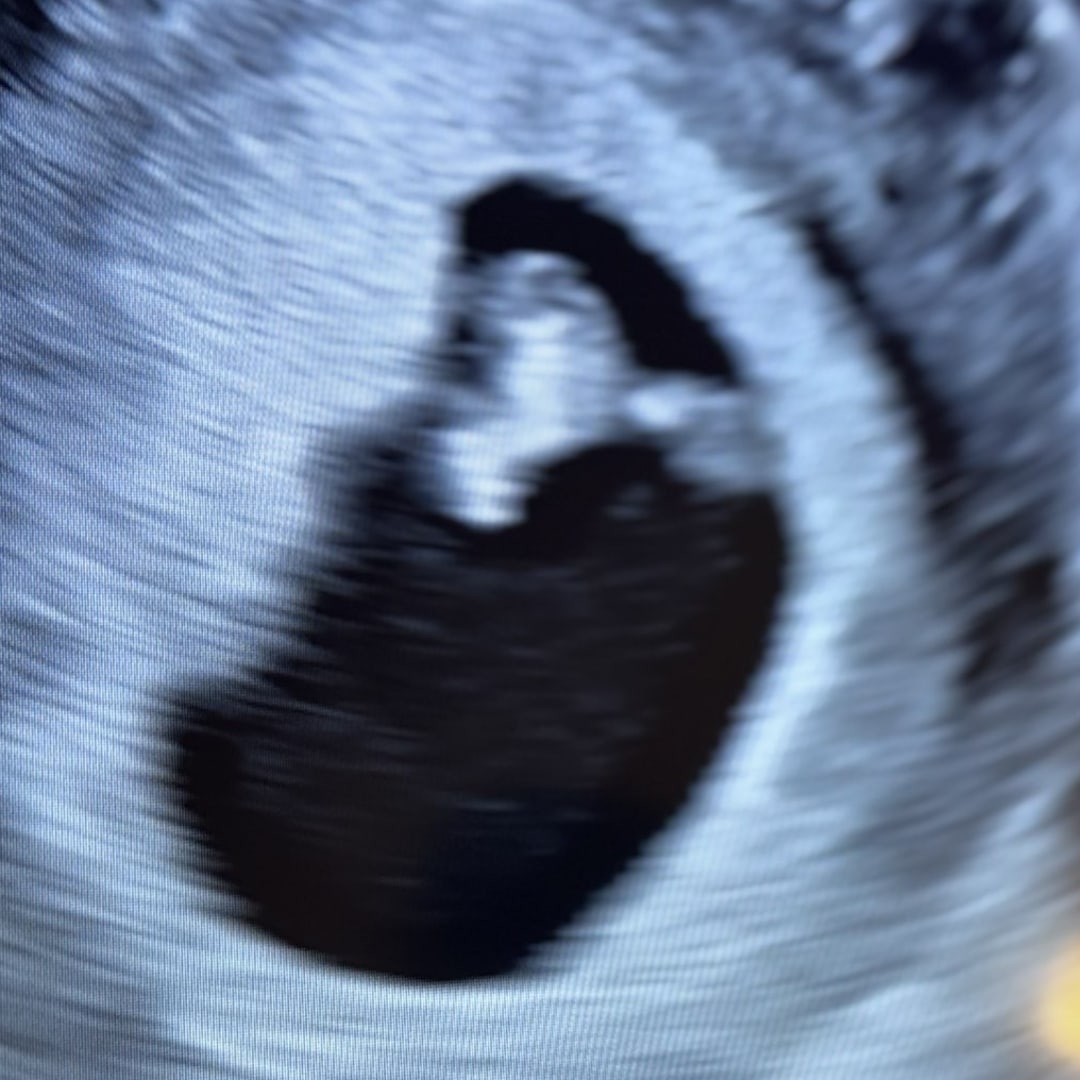 Photo shared by Jenna for their Babylist baby registry.