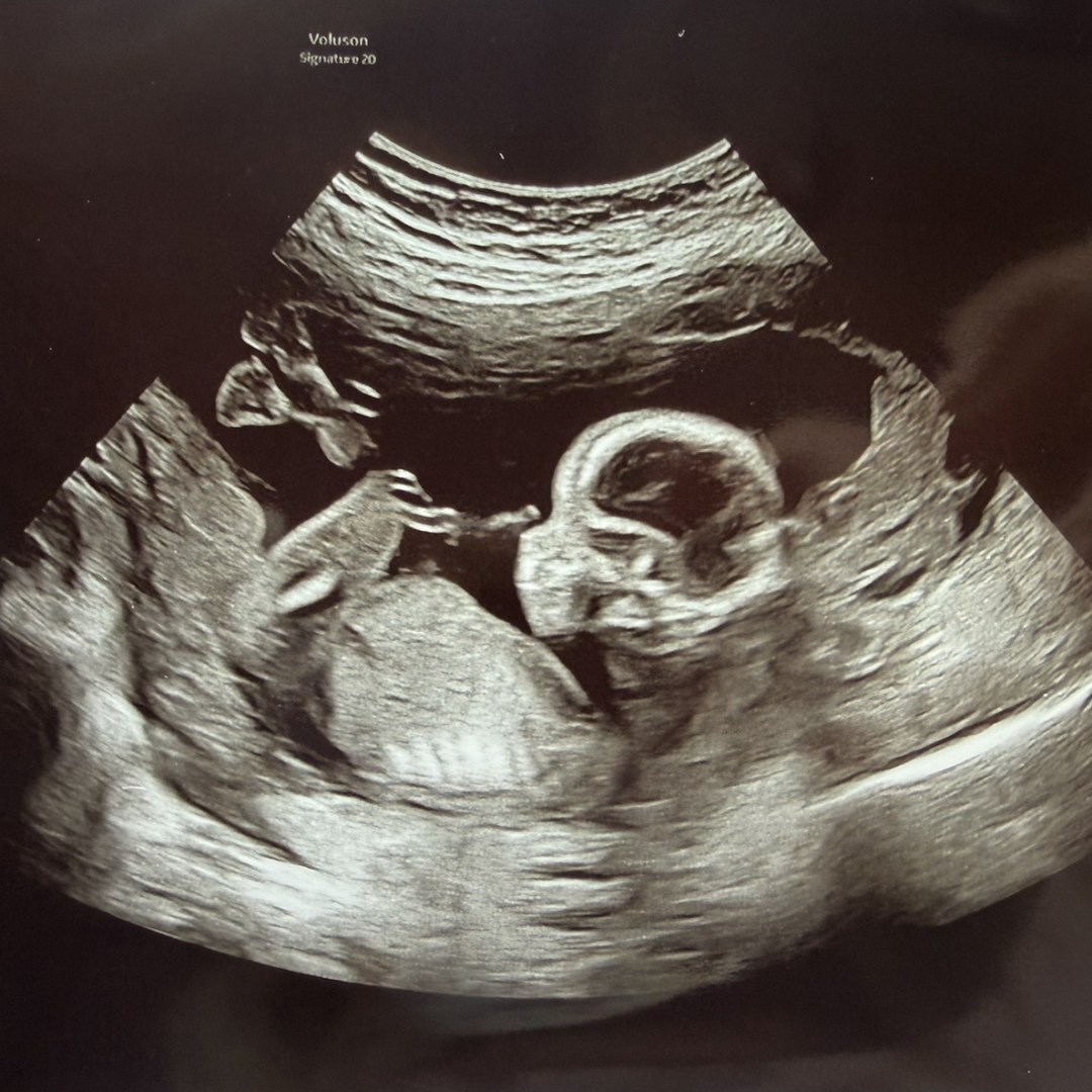 Photo shared by Hillary for their Babylist baby registry.
