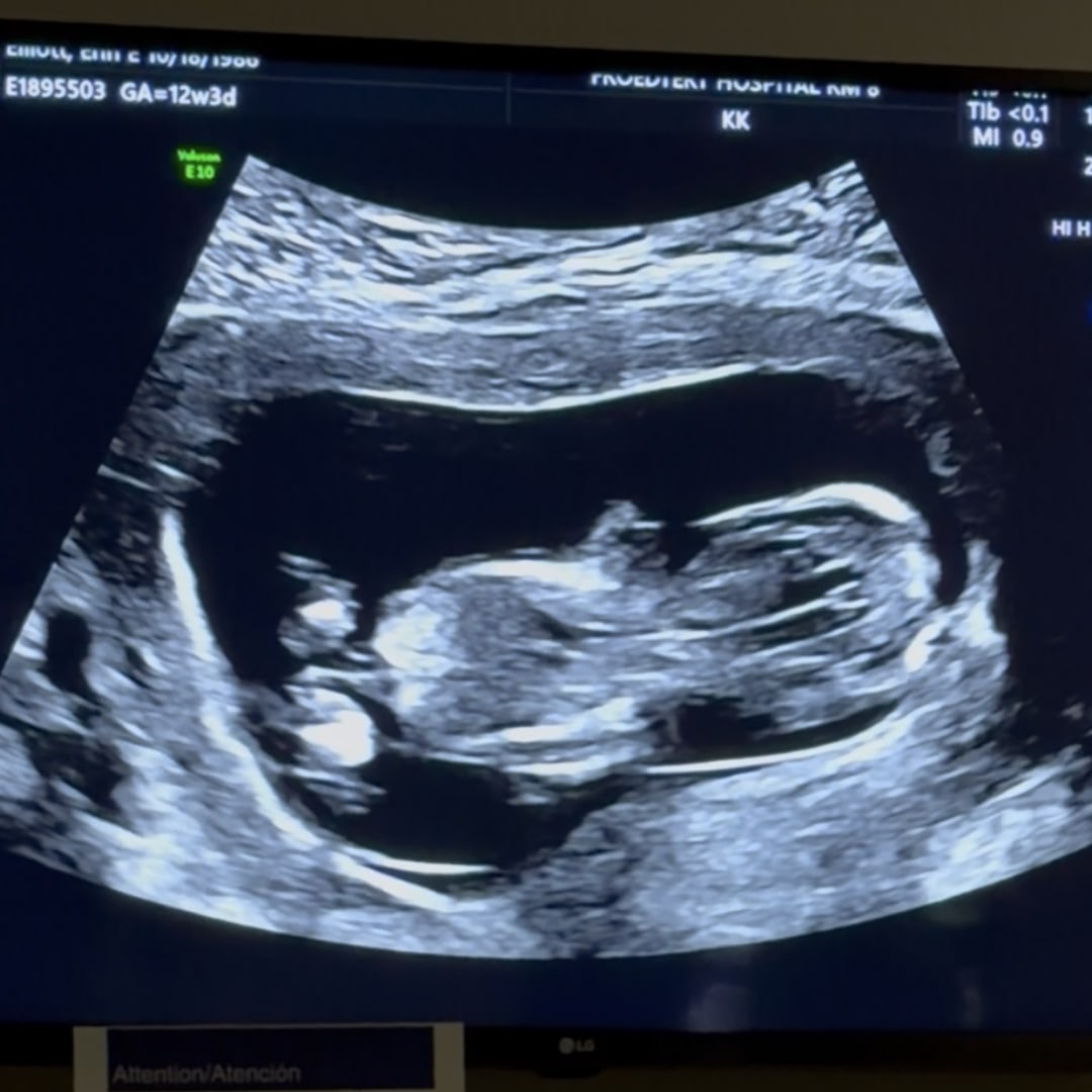 Photo shared by Erin for their Babylist baby registry.