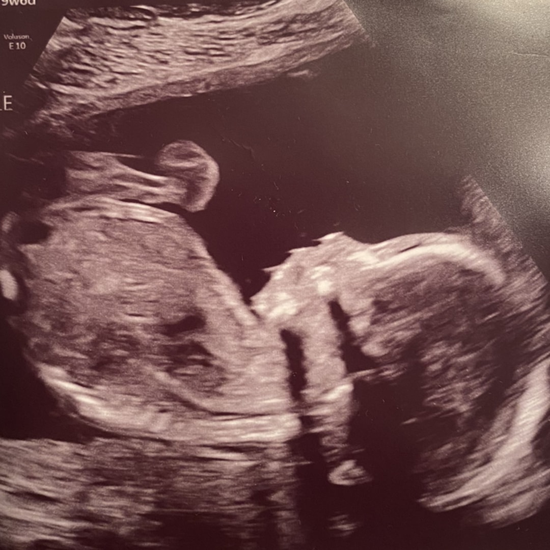 Photo shared by Holly for their Babylist baby registry.