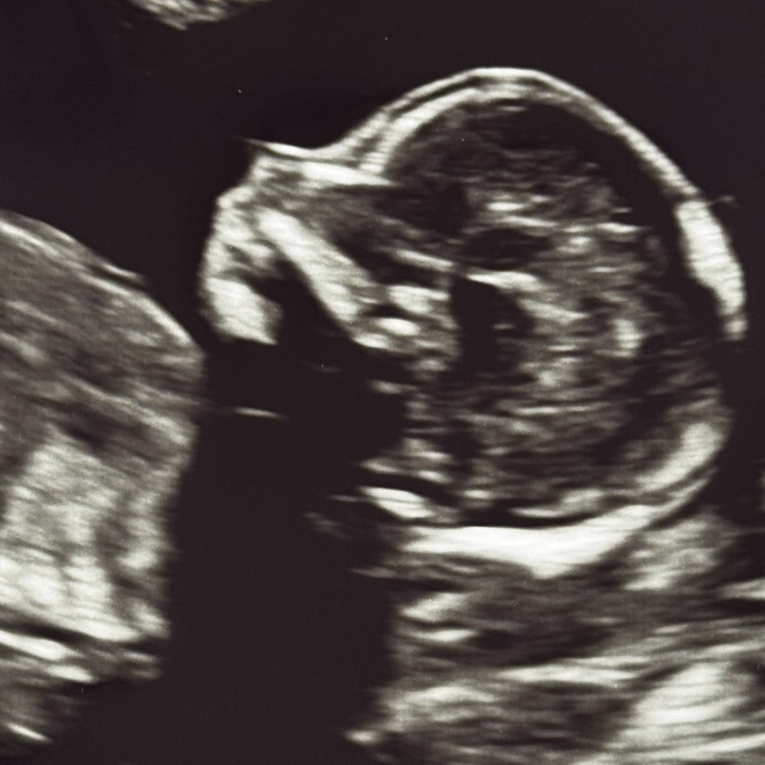 Photo shared by Emma for their Babylist baby registry.