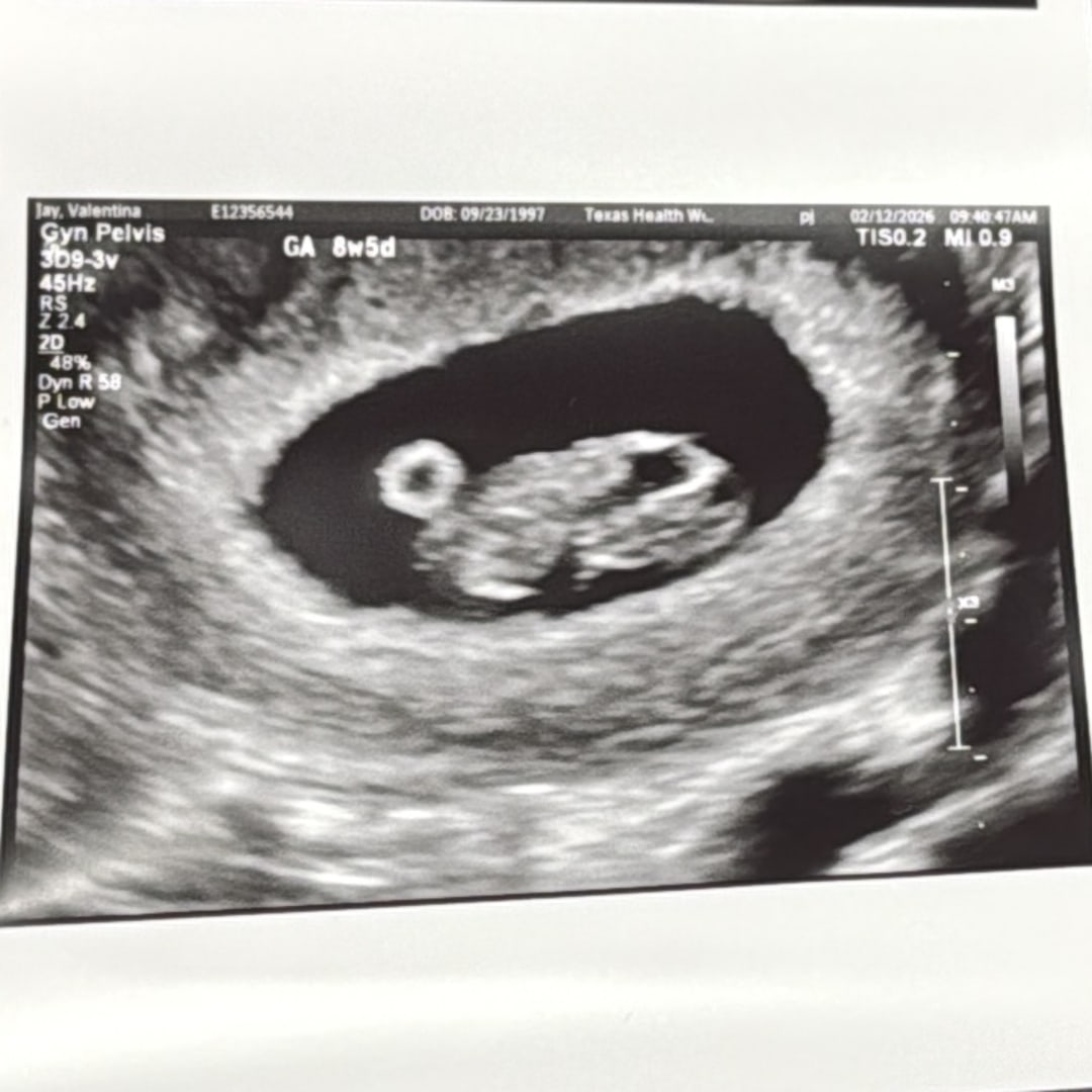 Photo shared by Valentina for their Babylist baby registry.
