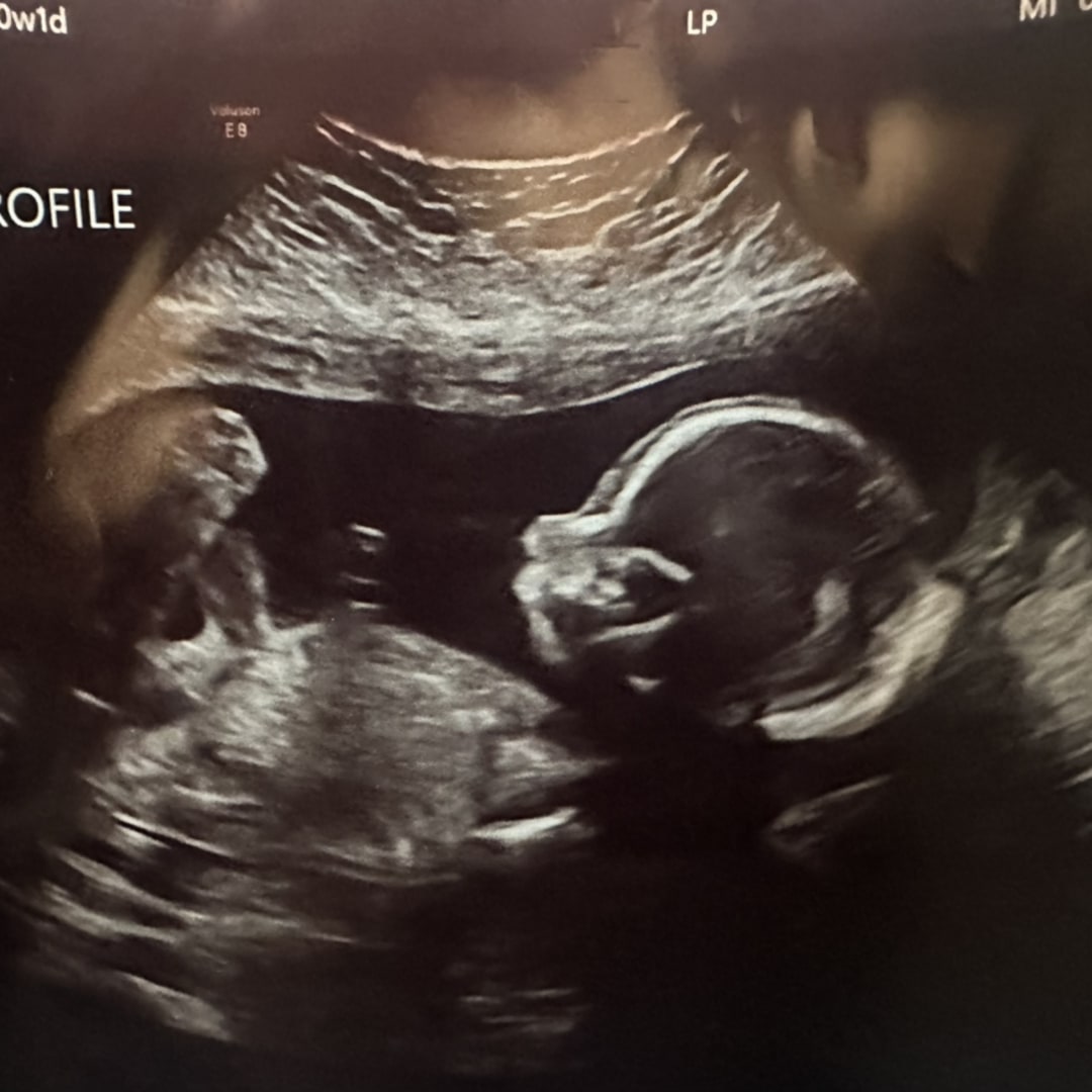 Photo shared by Carina for their Babylist baby registry.