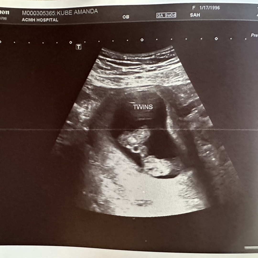 Photo shared by Amanda for their Babylist baby registry.