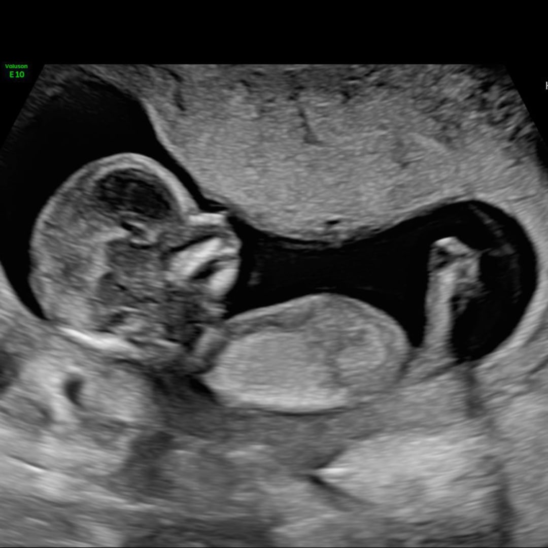 Photo shared by Auralila for their Babylist baby registry.