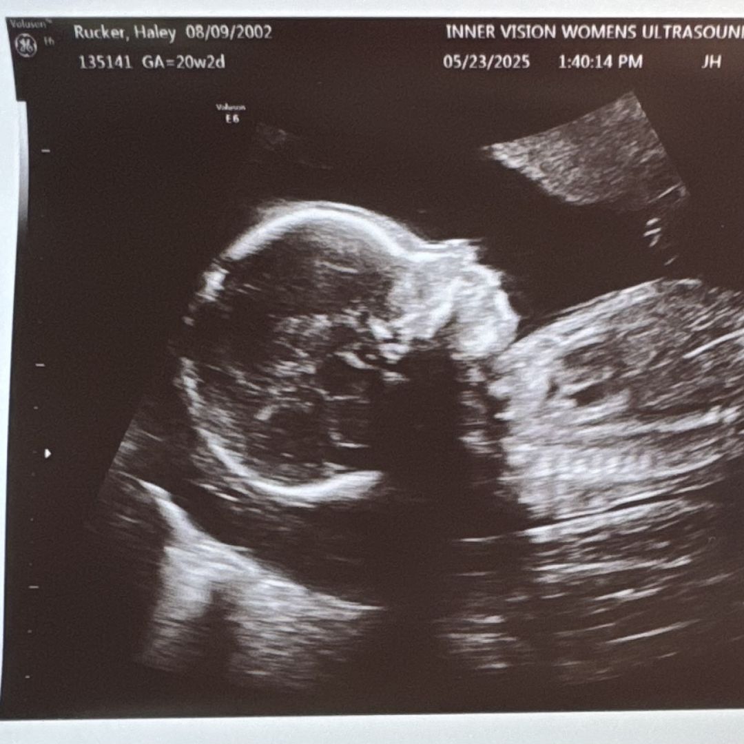 Photo shared by Haley for their Babylist baby registry.
