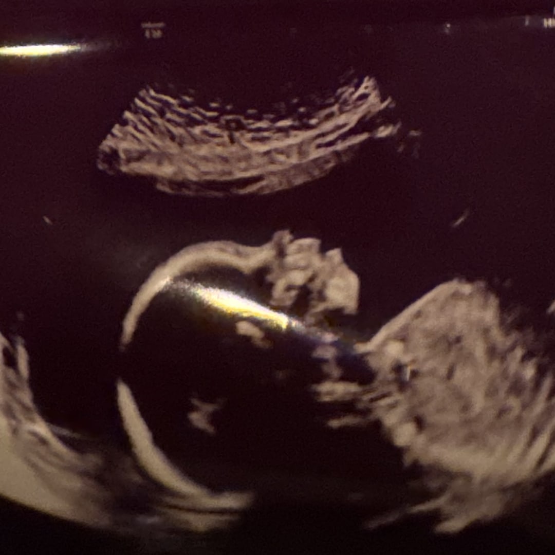 Photo shared by Joanna for their Babylist baby registry.