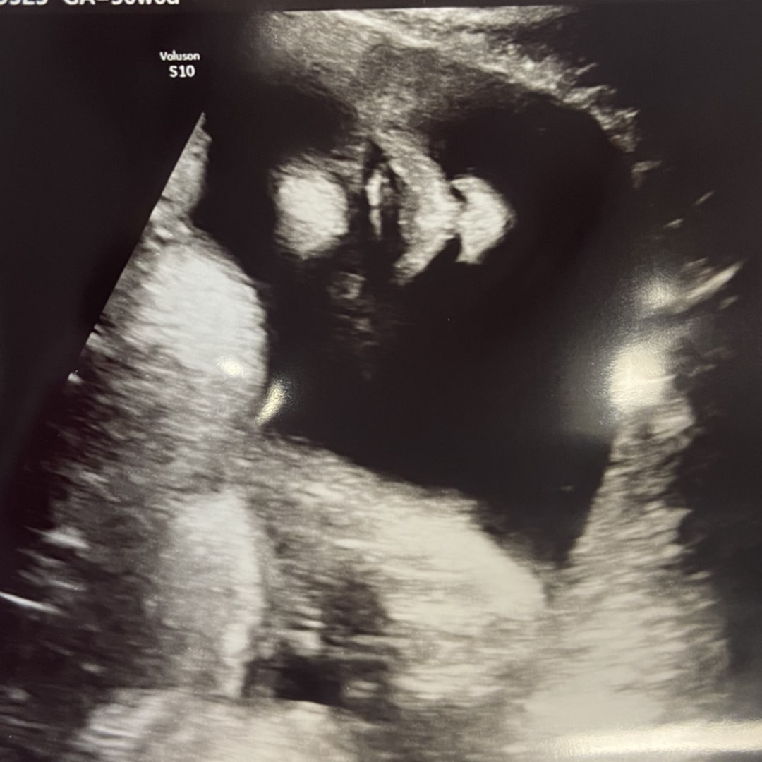 Photo shared by Keely for their Babylist baby registry.