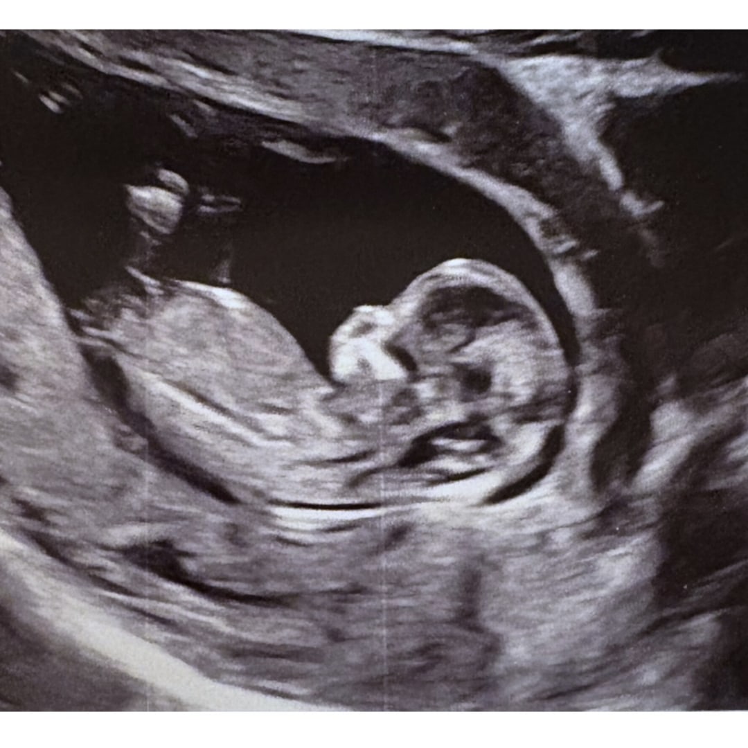 Photo shared by Diamond for their Babylist baby registry.