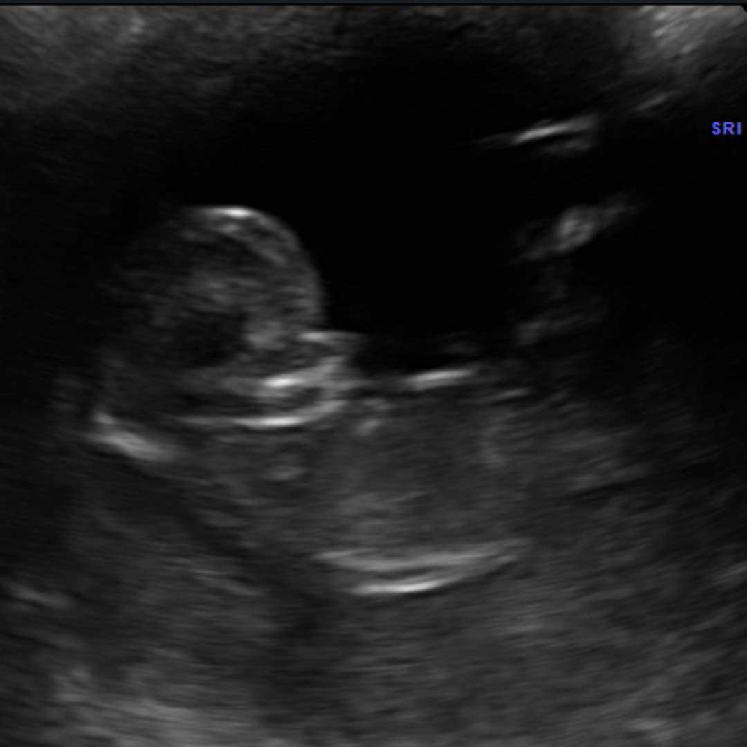 Photo shared by Breanne for their Babylist baby registry.