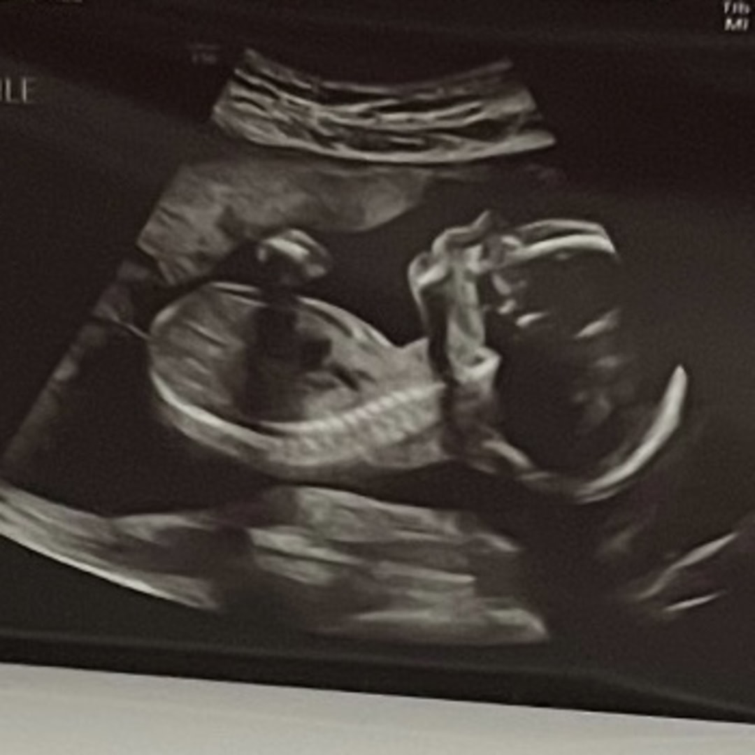 Photo shared by Aijalon for their Babylist baby registry.