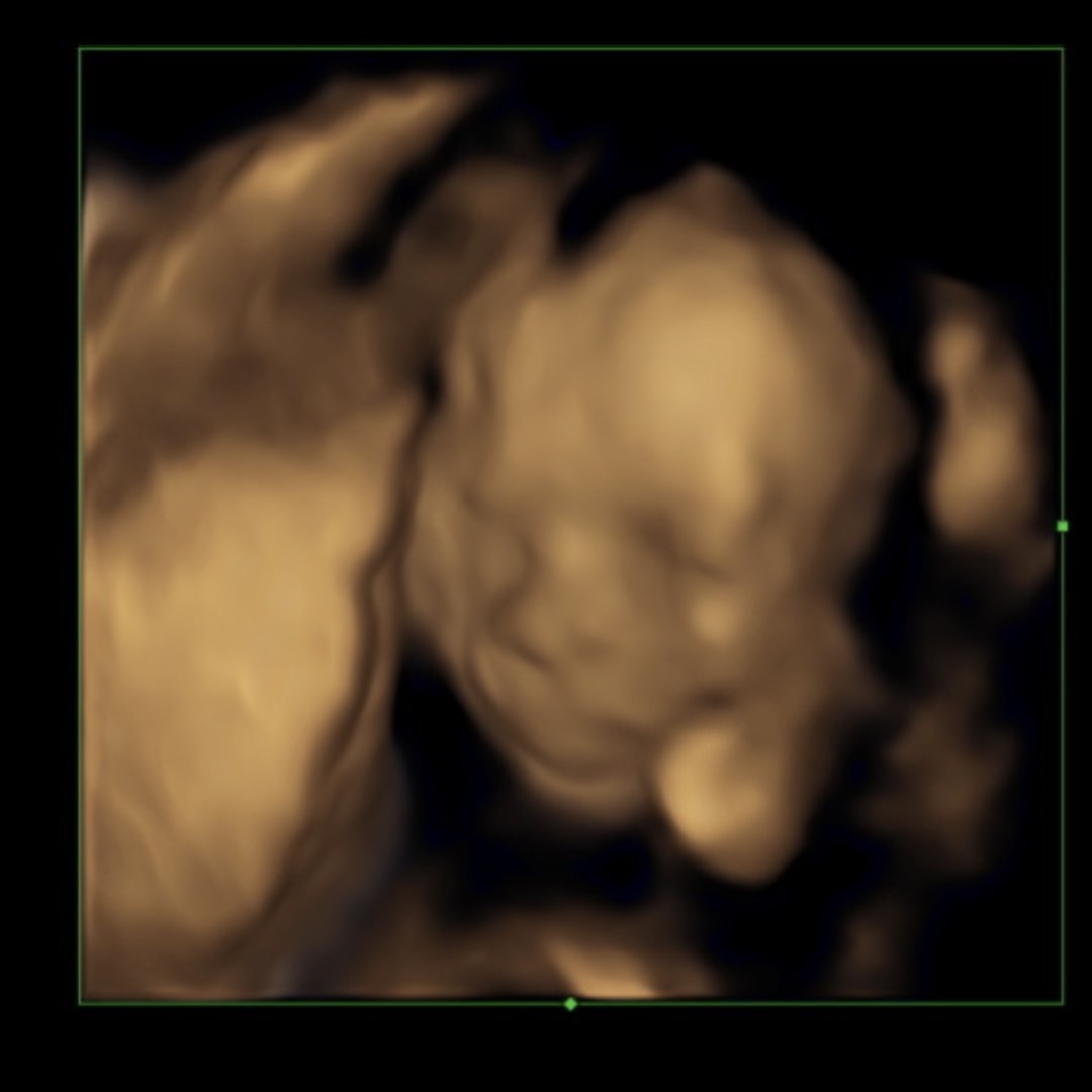 Photo shared by Carlie for their Babylist baby registry.