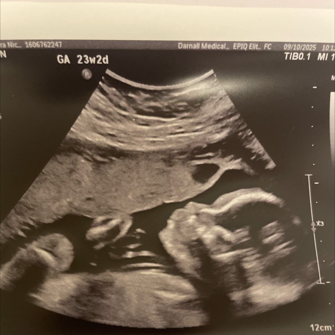 Photo shared by Sierra for their Babylist baby registry.