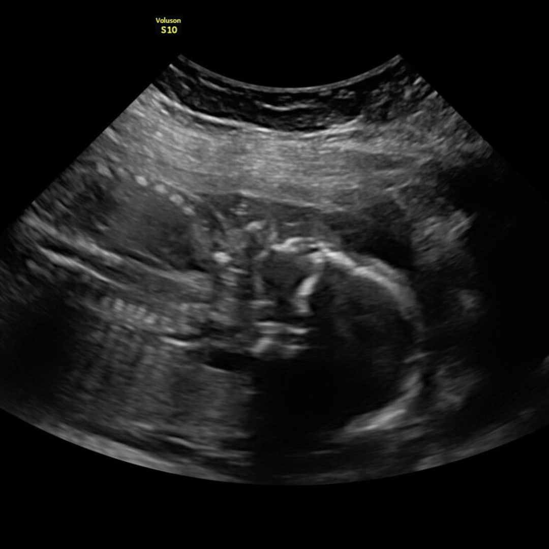 Photo shared by Jaidan for their Babylist baby registry.