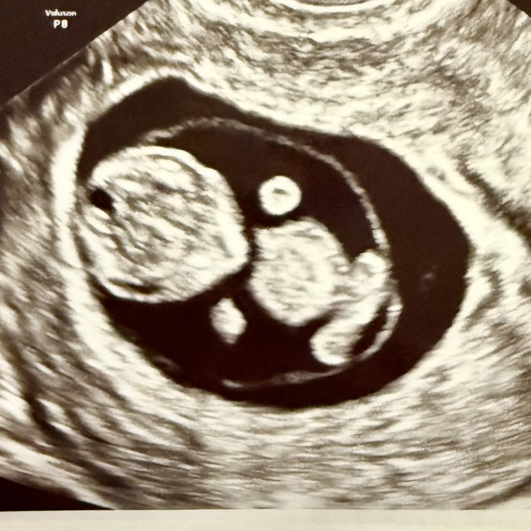 Photo shared by Laura for their Babylist baby registry.