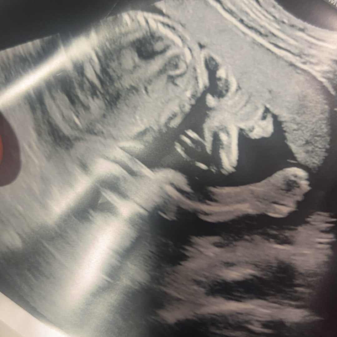 Photo shared by Meljanae for their Babylist baby registry.