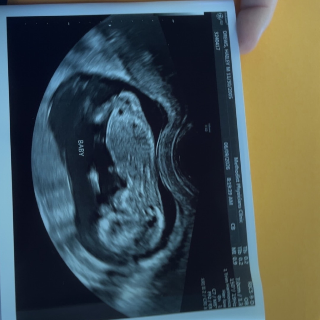 Photo shared by Hailey for their Babylist baby registry.