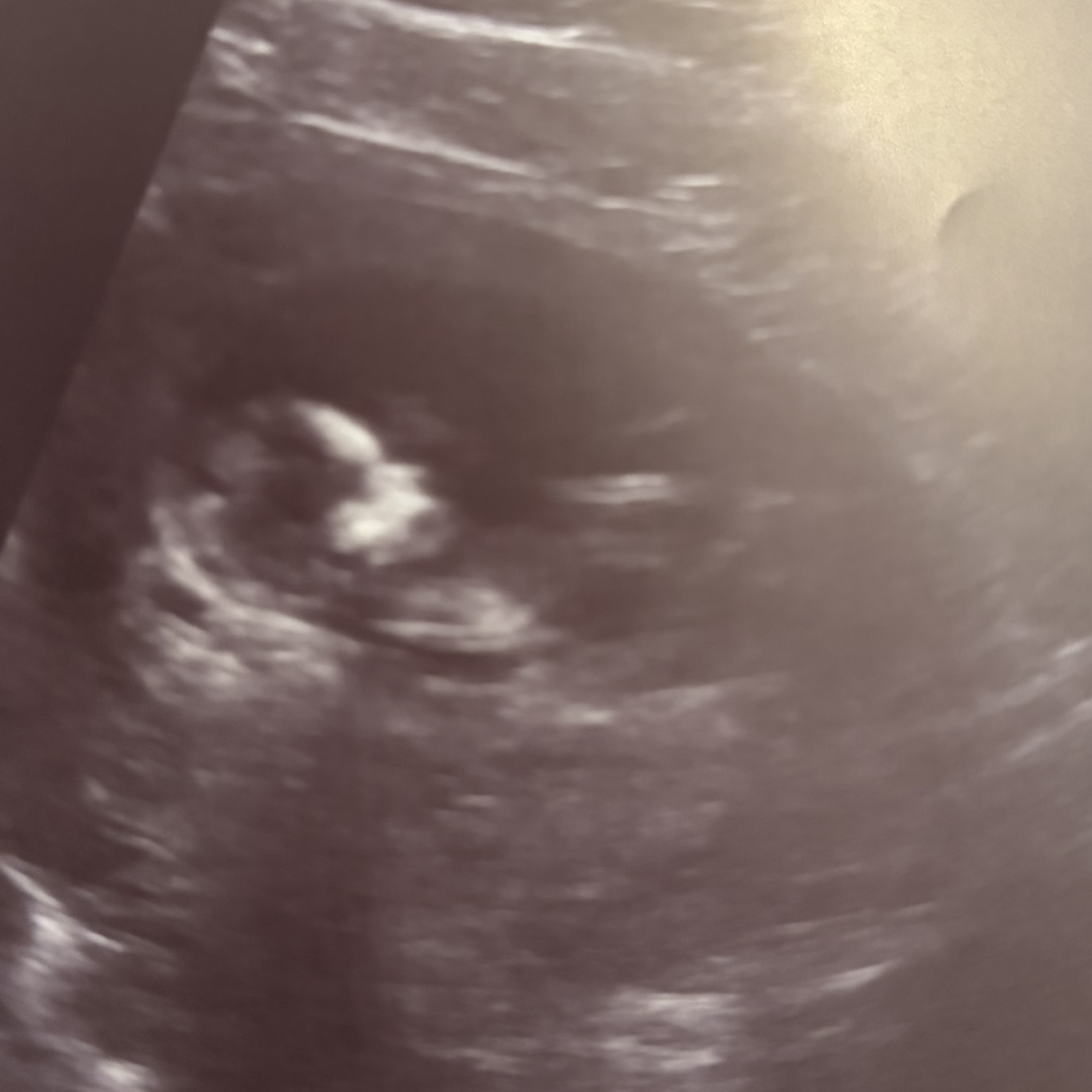 Photo shared by Natalee for their Babylist baby registry.