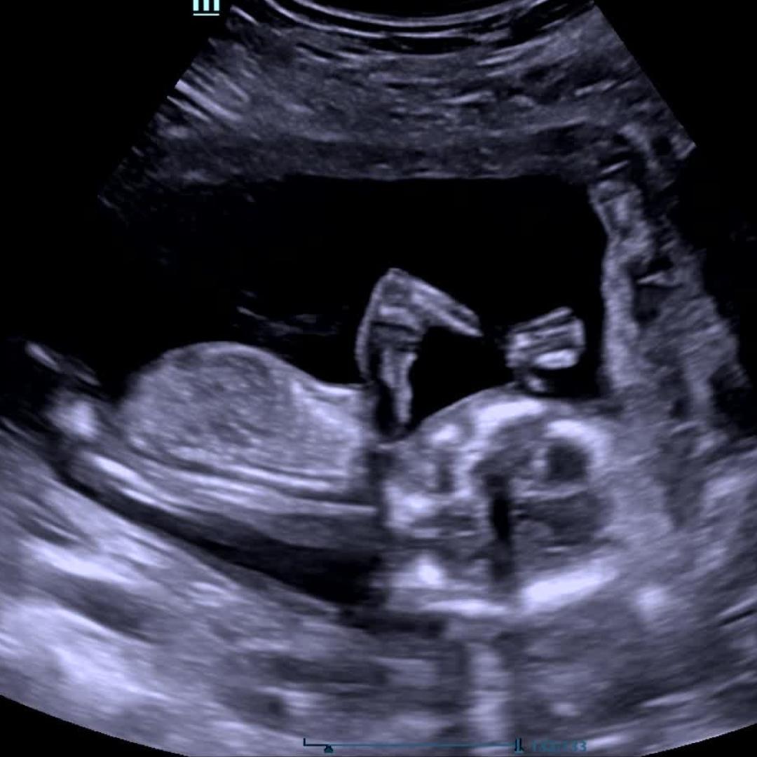 Photo shared by Jessica for their Babylist baby registry.