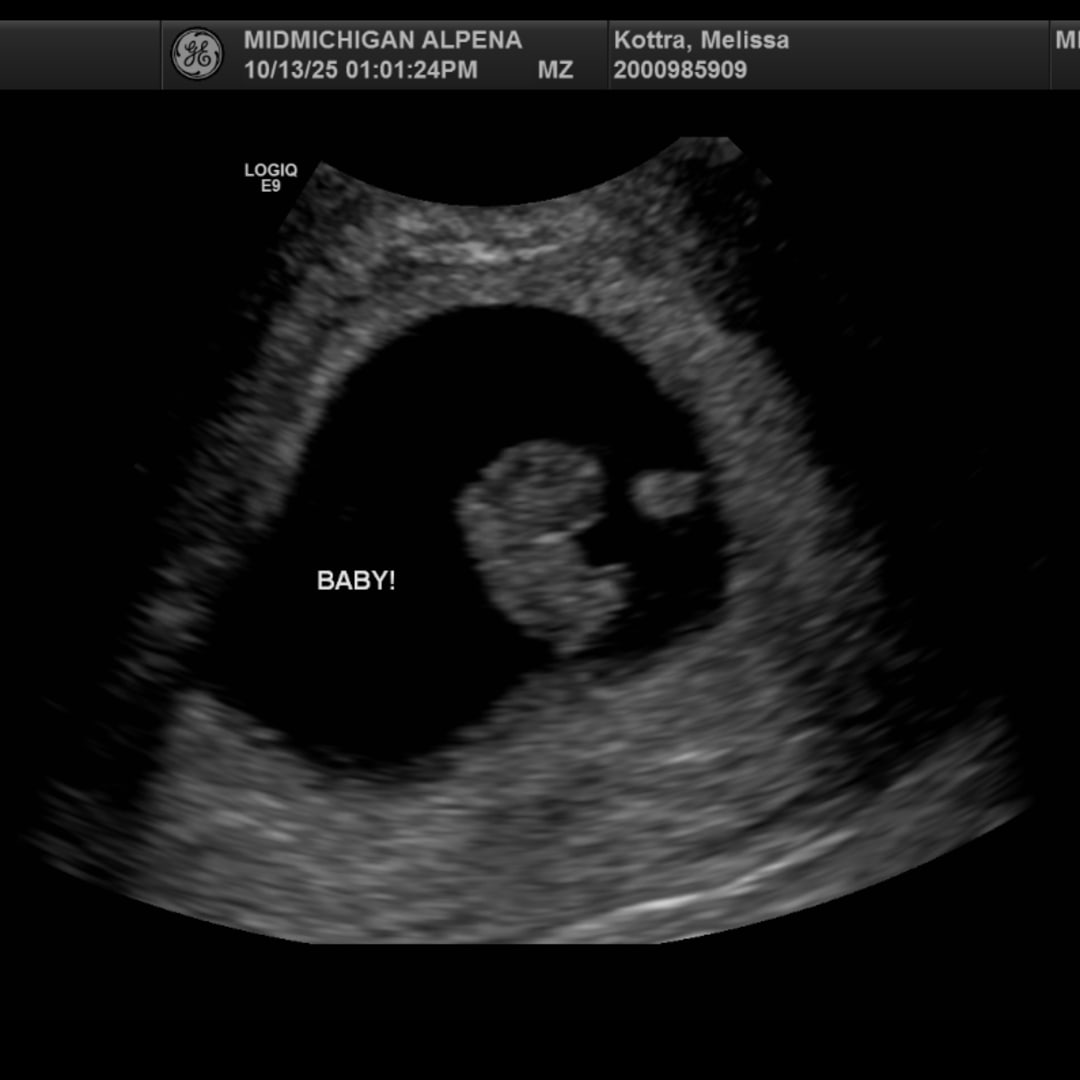 Photo shared by Melissa for their Babylist baby registry.