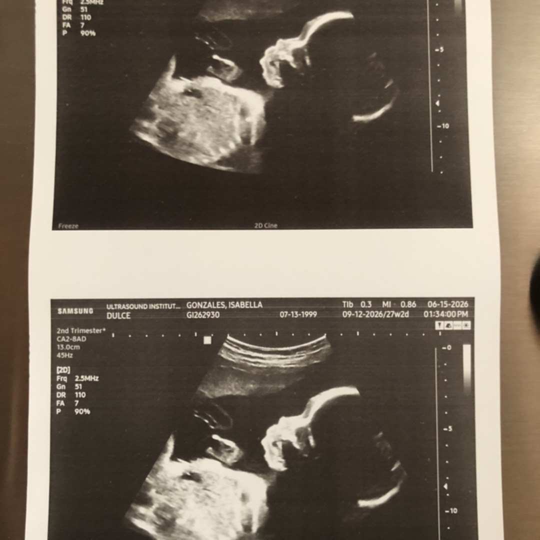 Photo shared by Isabella for their Babylist baby registry.