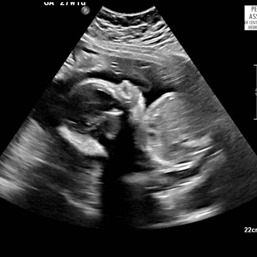 Photo shared by Brandi for their Babylist baby registry.