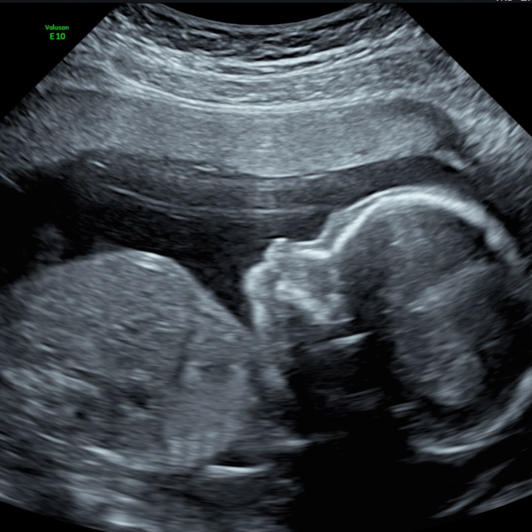 Photo shared by Chloe for their Babylist baby registry.