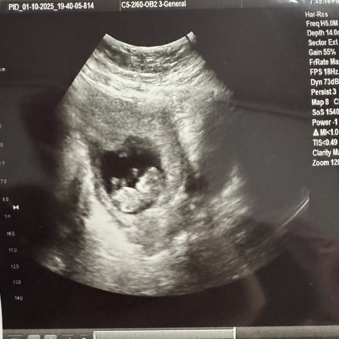 Photo shared by Cassandra for their Babylist baby registry.