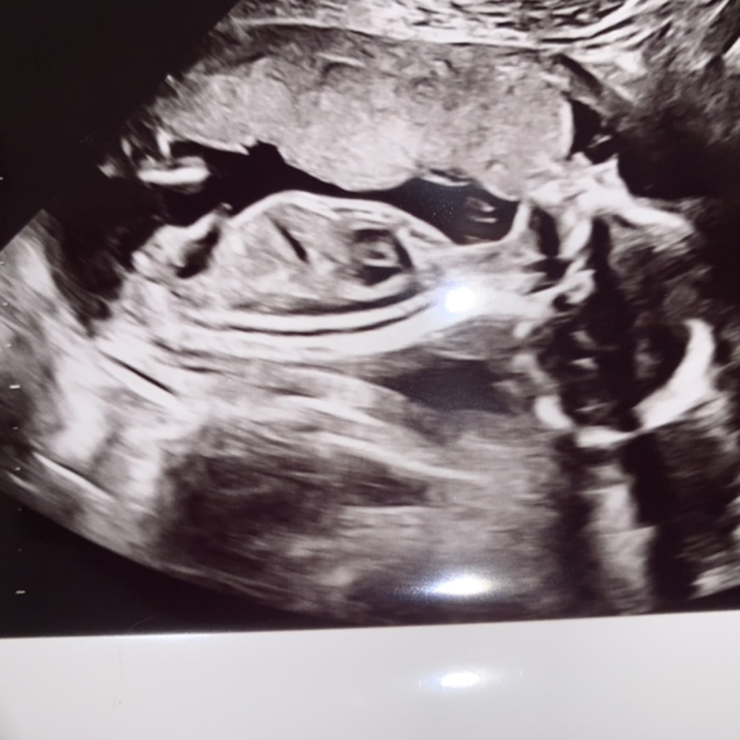 Photo shared by Karter for their Babylist baby registry.