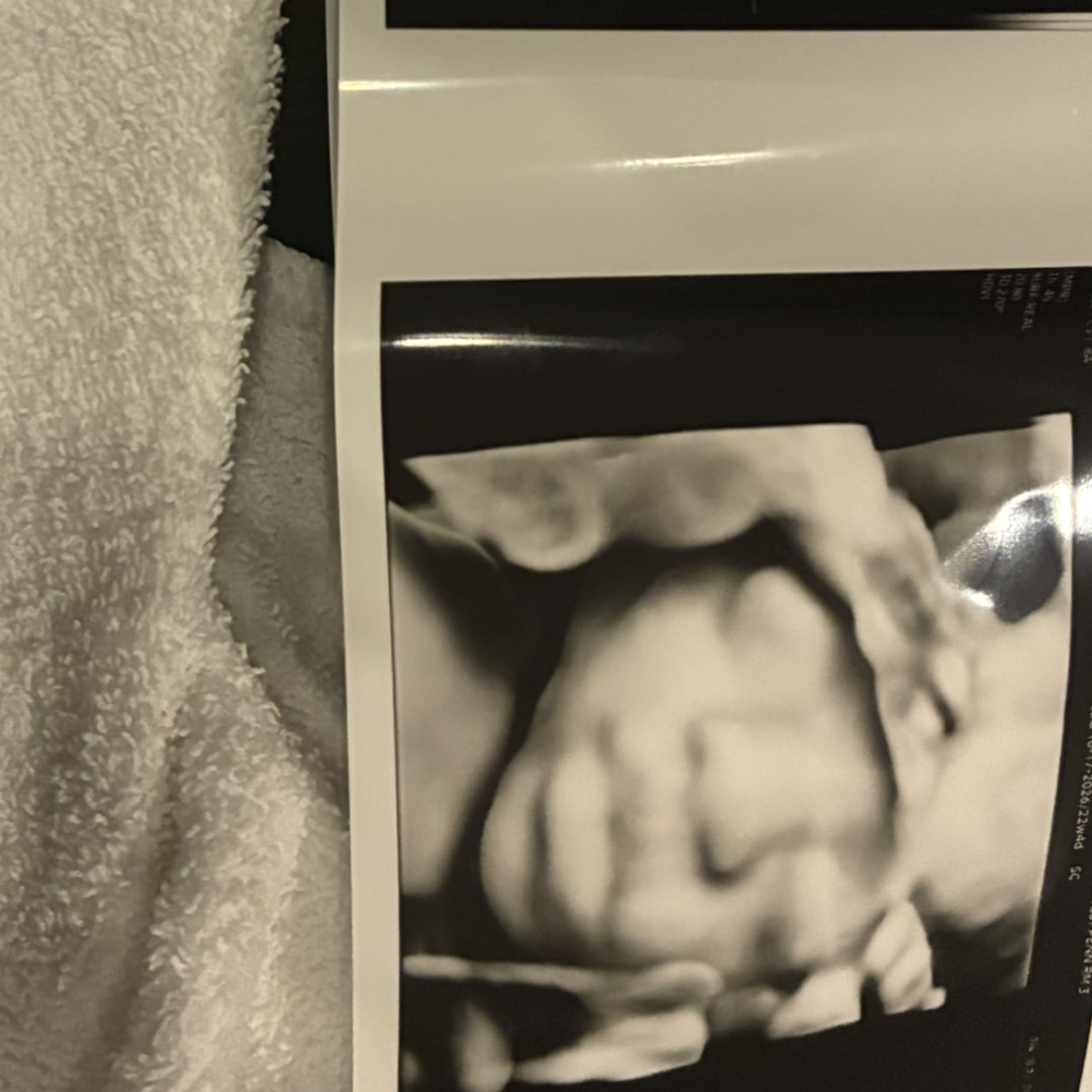 Photo shared by Brikal for their Babylist baby registry.