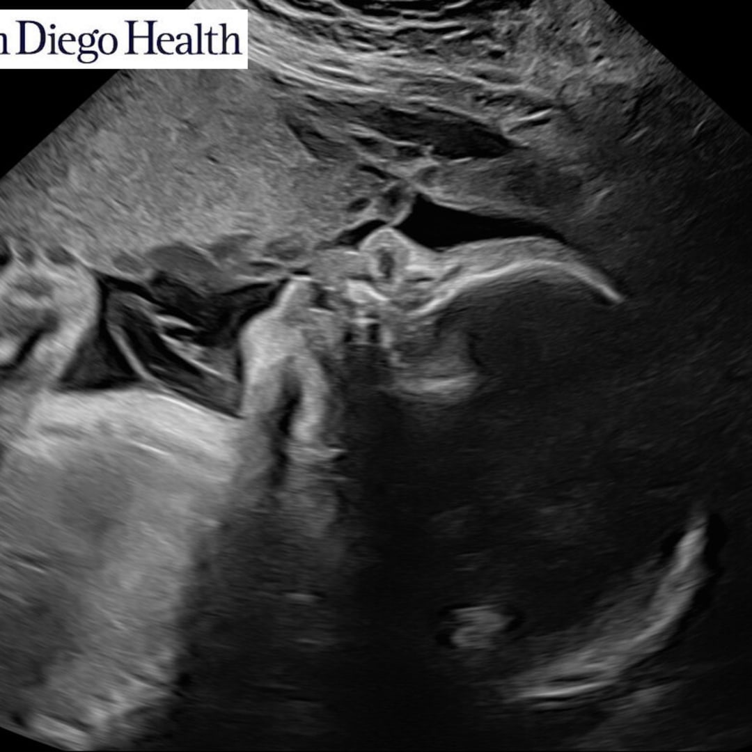 Photo shared by Anabelle for their Babylist baby registry.