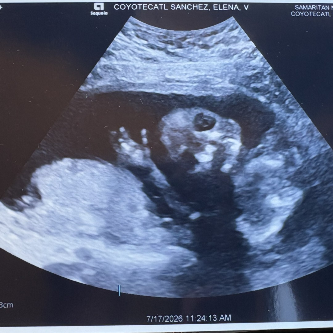 Photo shared by Elena for their Babylist baby registry.