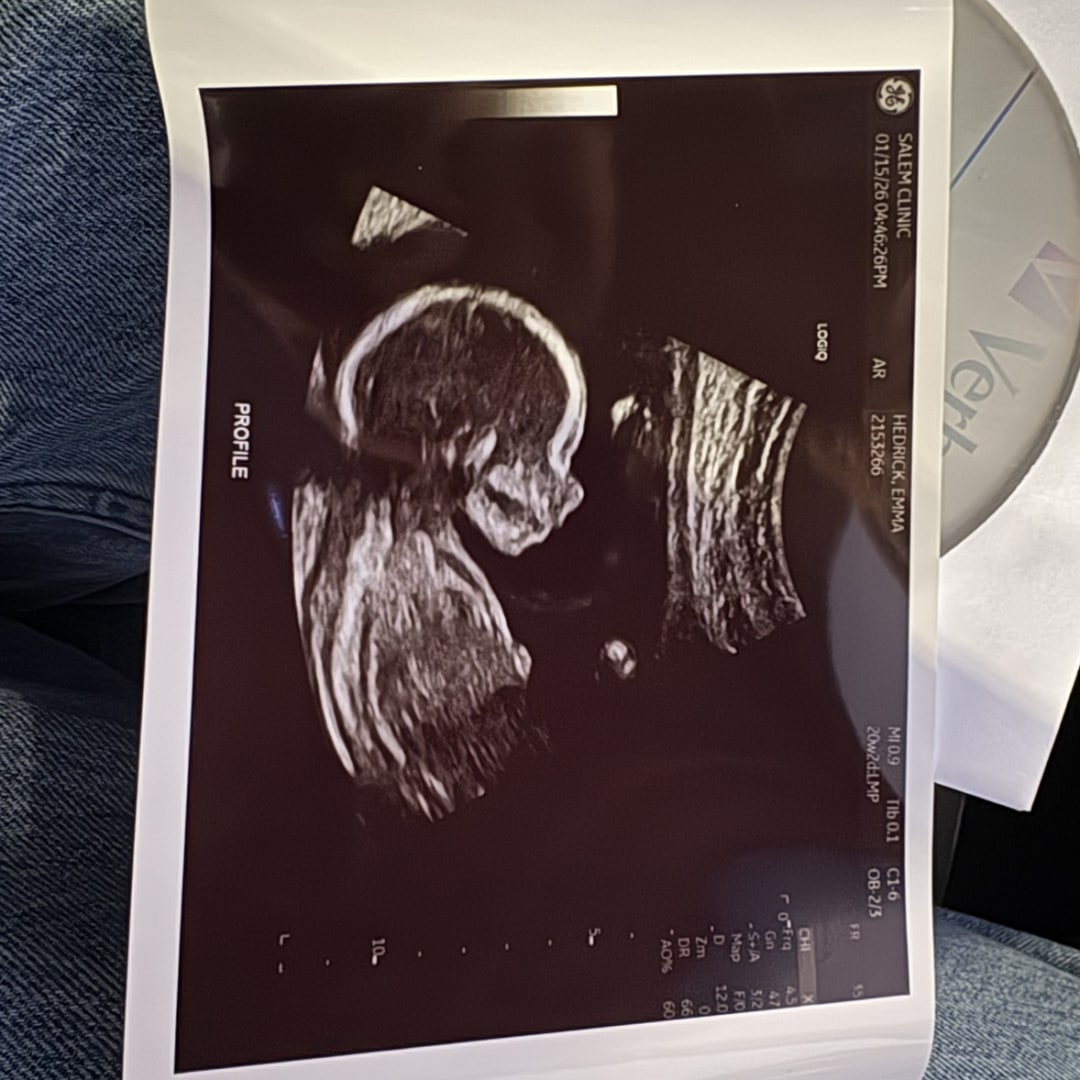 Photo shared by Emma for their Babylist baby registry.