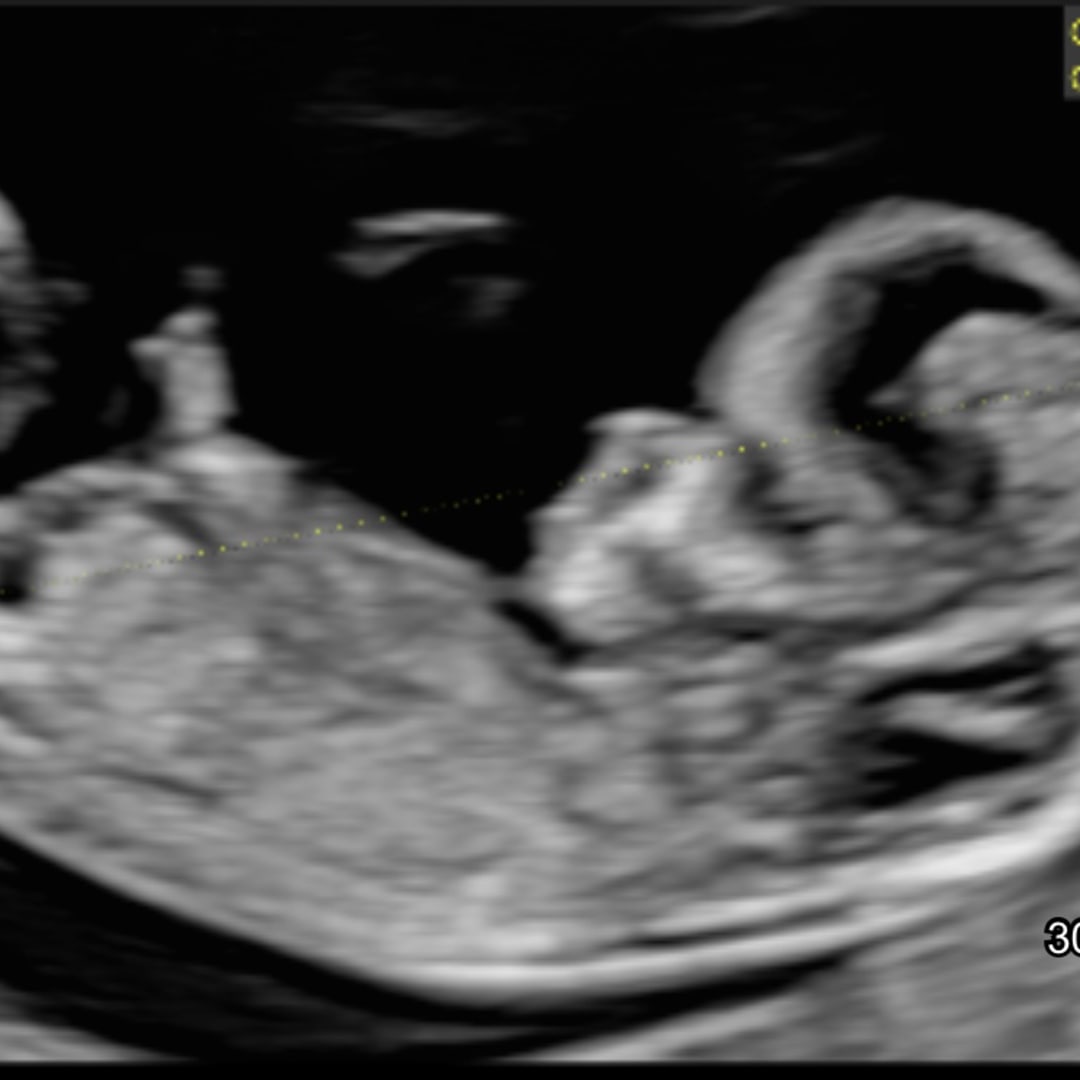 Photo shared by Cristina for their Babylist baby registry.