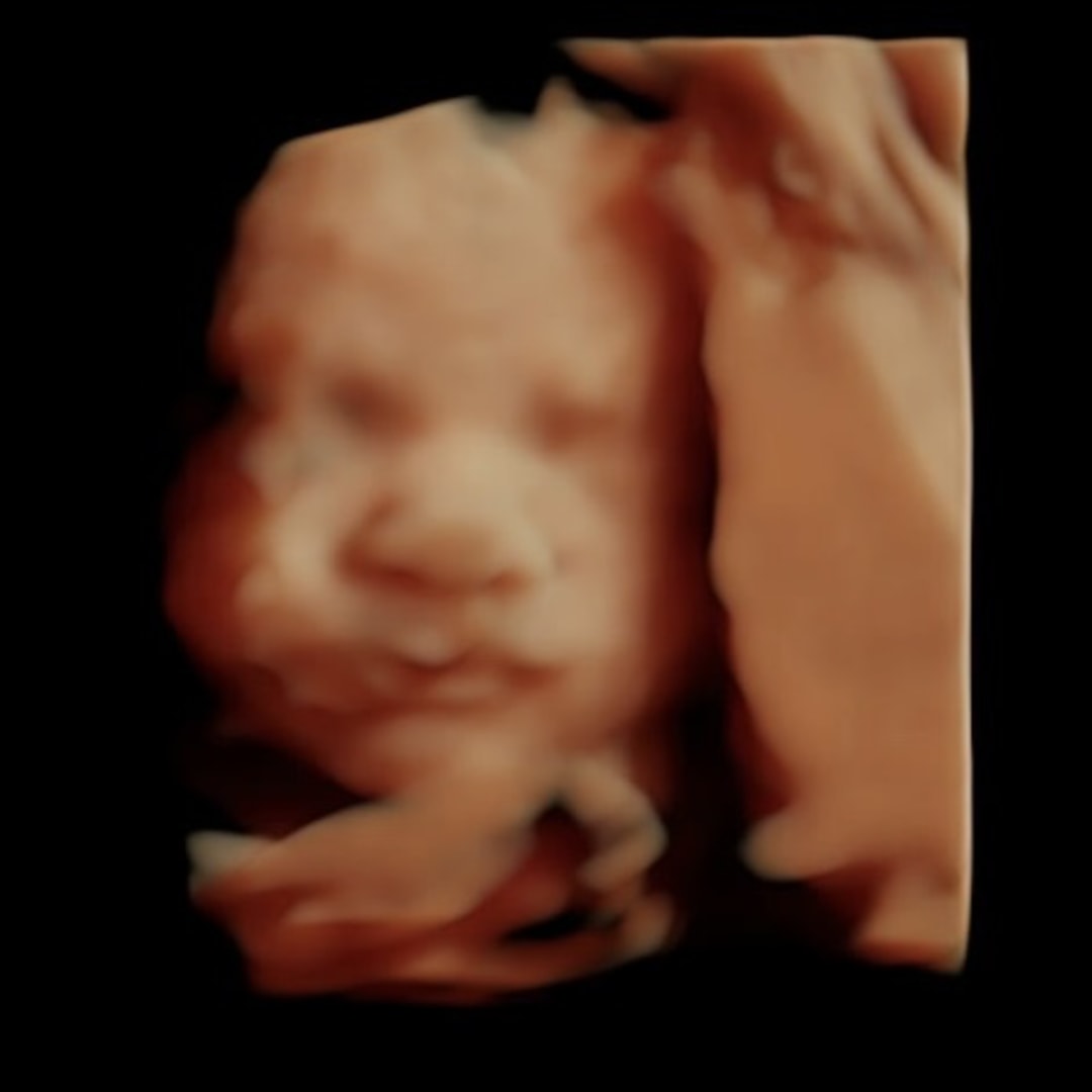 Photo shared by Gemma for their Babylist baby registry.