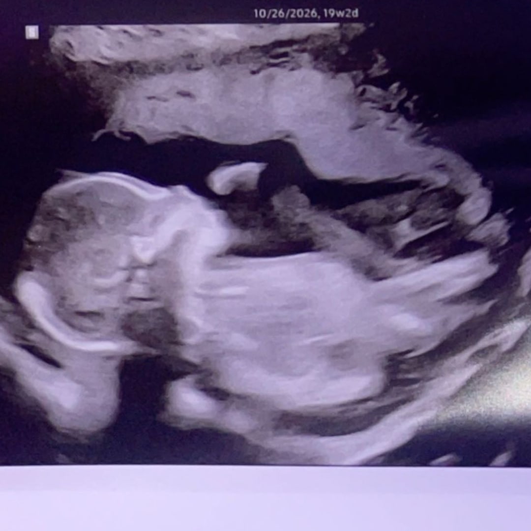 Photo shared by Bree for their Babylist baby registry.