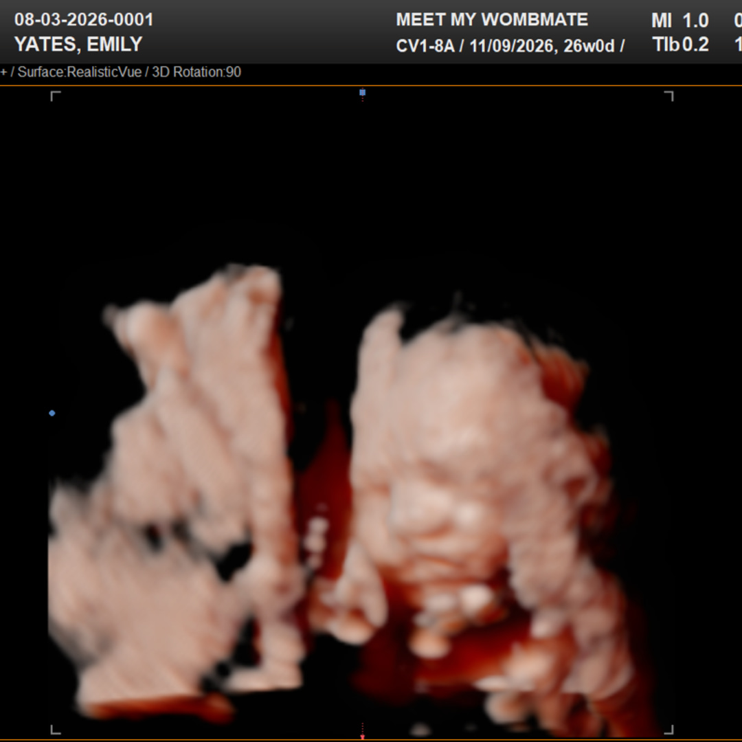 Photo shared by Emily for their Babylist baby registry.